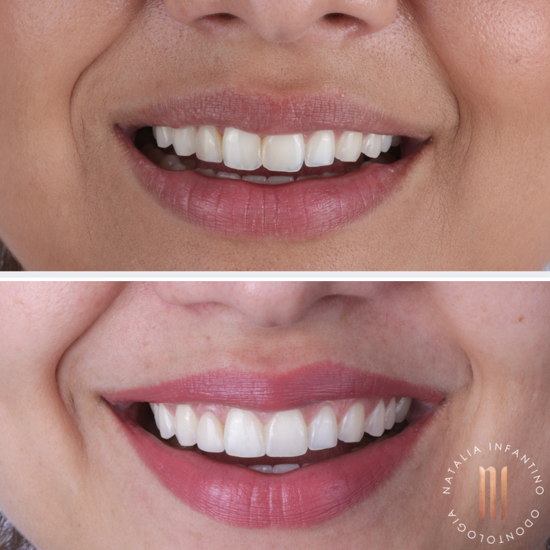 02E8C95D-6A88-48D8-9806-583EA1FB0884